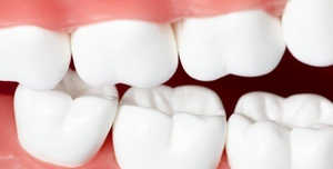 зубы, стоматология